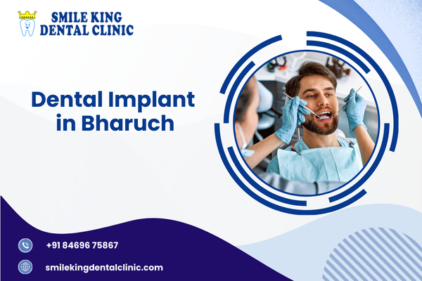 Dental Implant in Bharuch