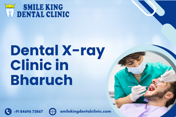 Dental X-ray Clinic in Bharuch