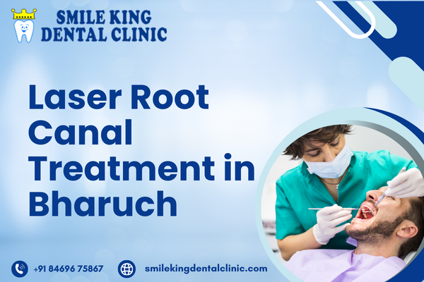 Laser Root Canal Treatment in Bharuch