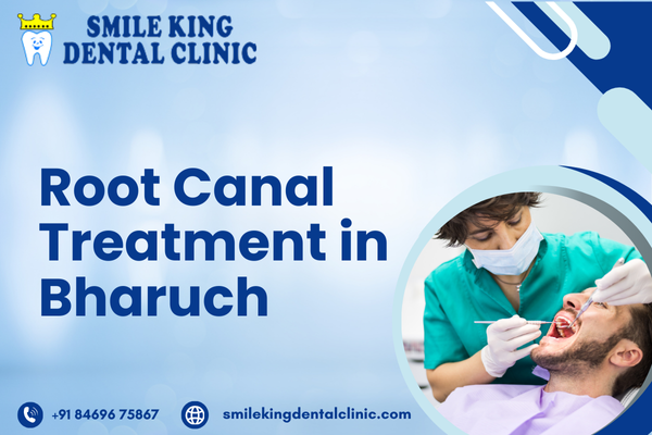 Root Canal Treatment in Bharuch