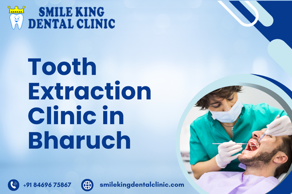 Tooth Extraction Clinic in Bharuch