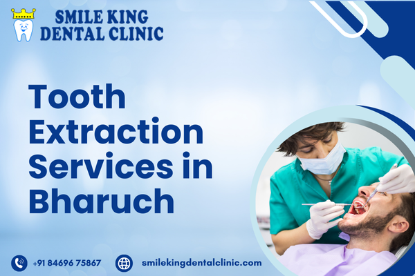 Tooth Extraction Services in Bharuch